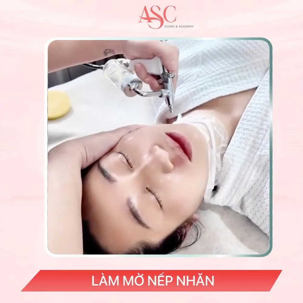 Dịch vụ nâng cơ xóa mờ nếp nhăn