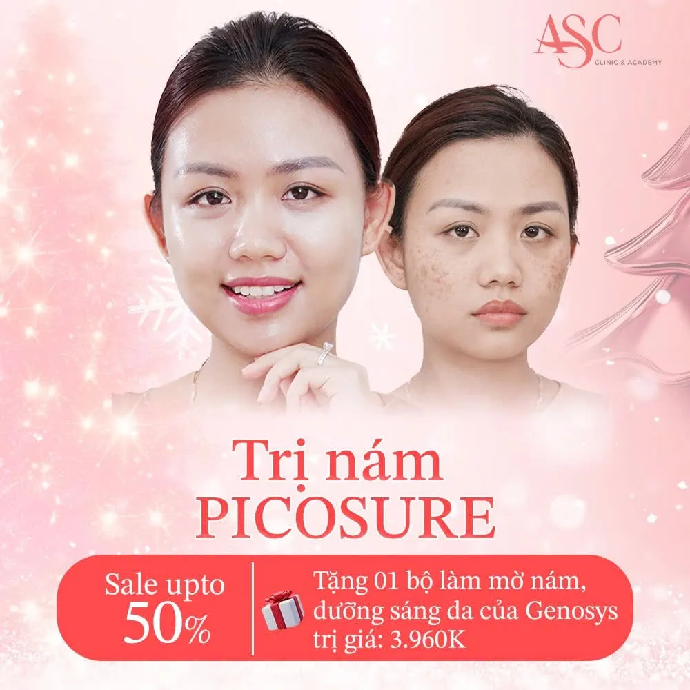 Dịch vụ trị nám