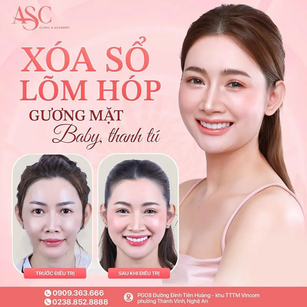 Đăng ký tư vấn
